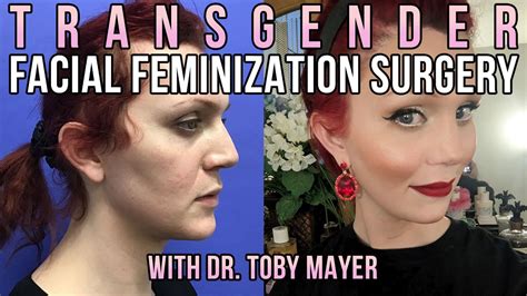 transexual self facial|Transgender Facial Feminization Surgery .